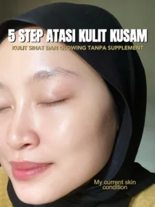 Tentu, mari kita bahas cara mengatasi kulit kusam dalam sebuah artikel informatif dan mudah dipahami.